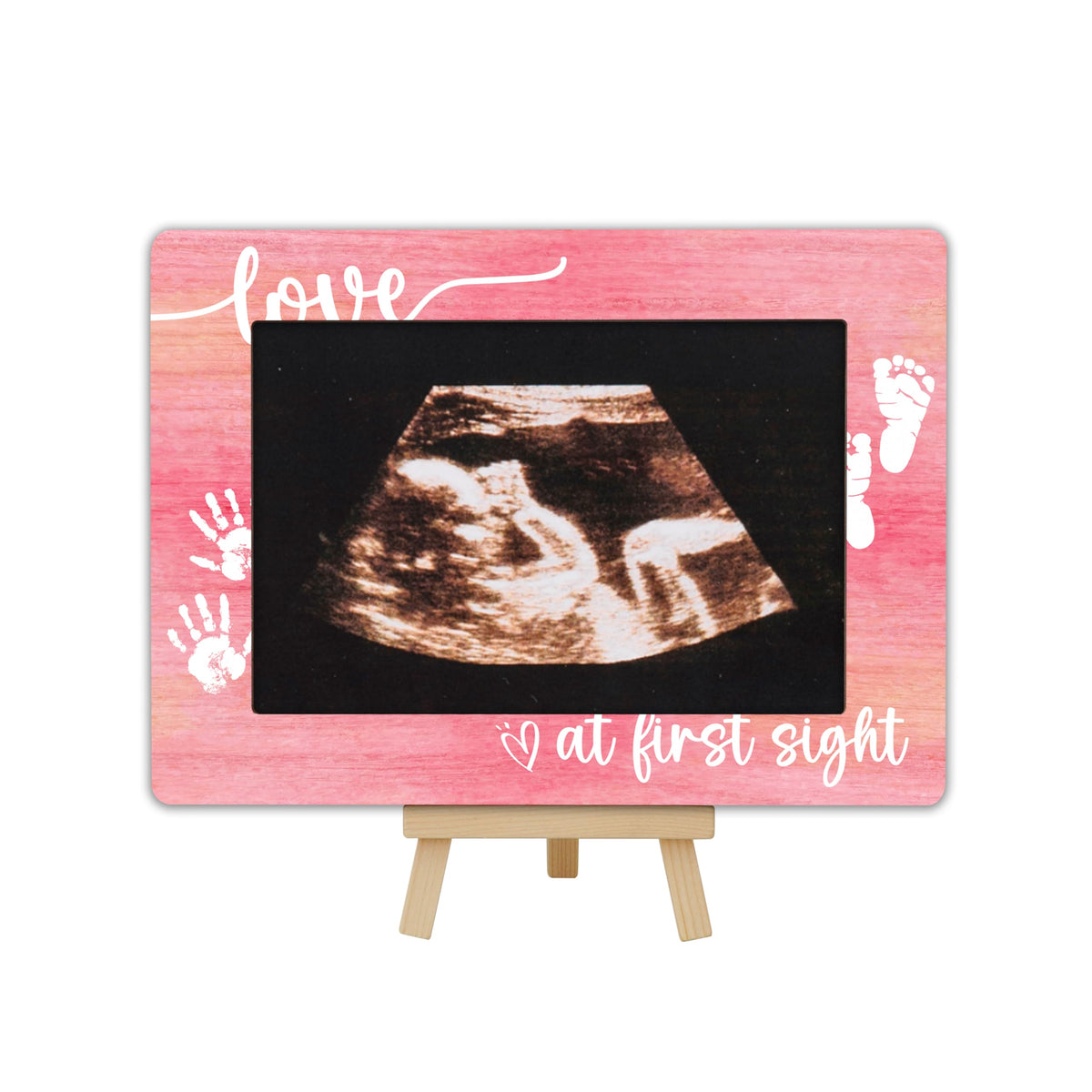 OXRUN New Mom Gifts frame showcases ultrasound image for a heartfelt memory display.