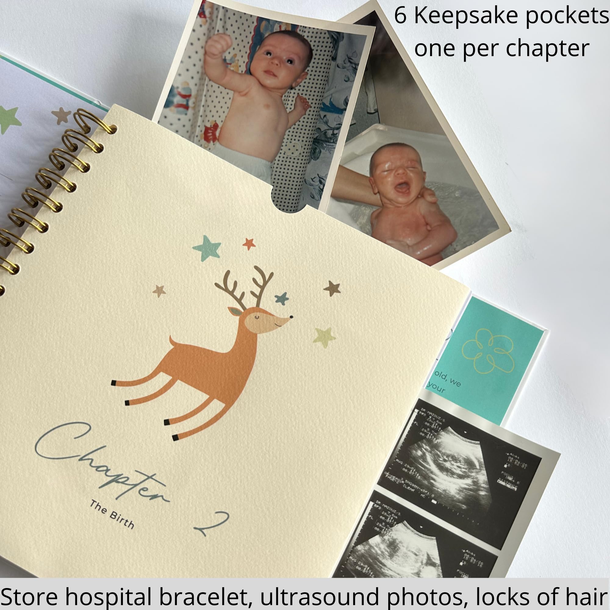 Raytiss Little You hospital bracelet pocket demonstrates preserved keepsakes in a protective pocket.