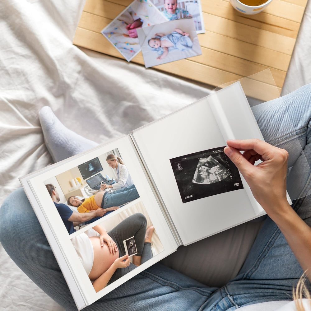 Remowith photo layout supports 2x3, 4x6, and 5x7 formats for versatile albums.