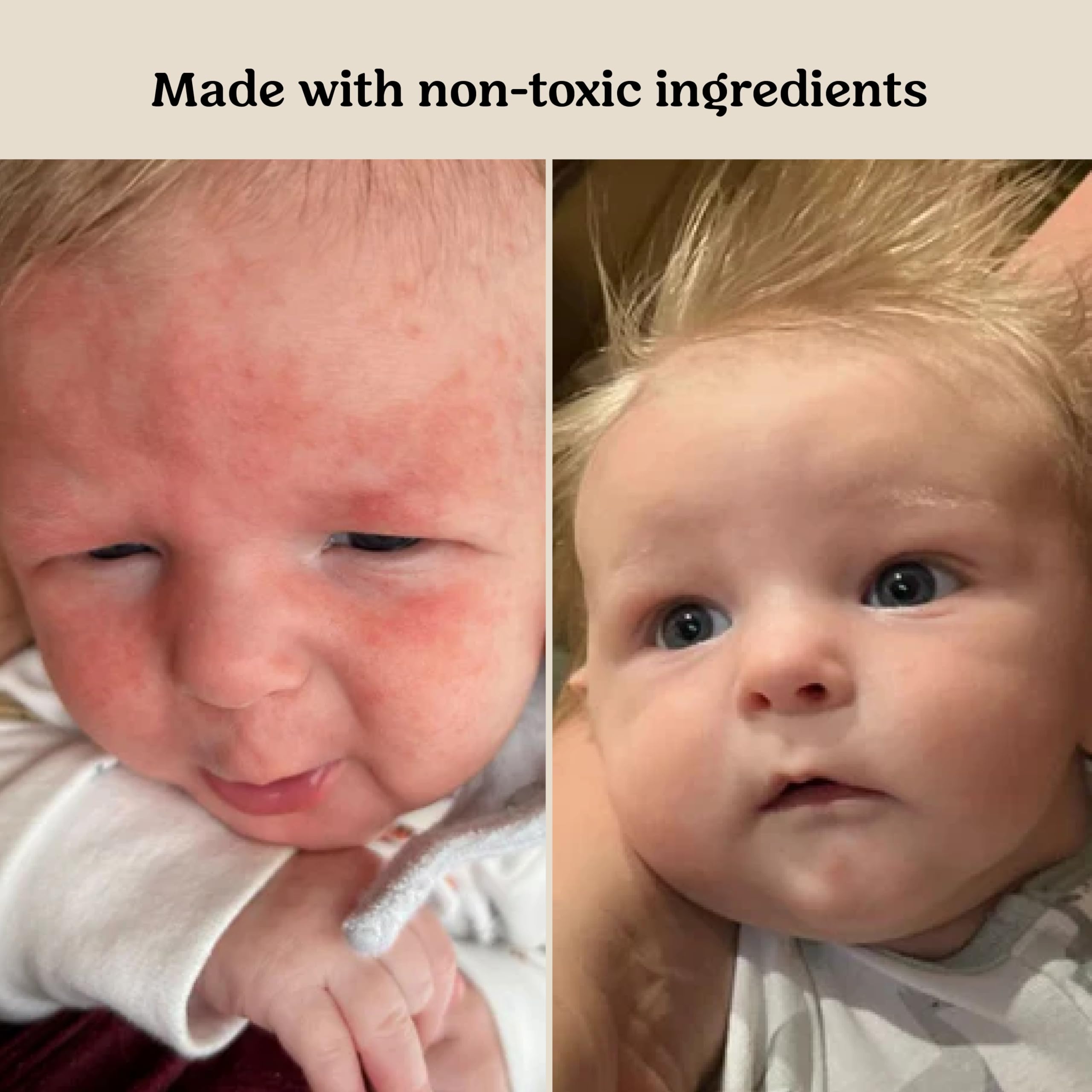 Roe Wellness baby cream lotion ointment antioxidants closeup emphasizes protection and soothing care