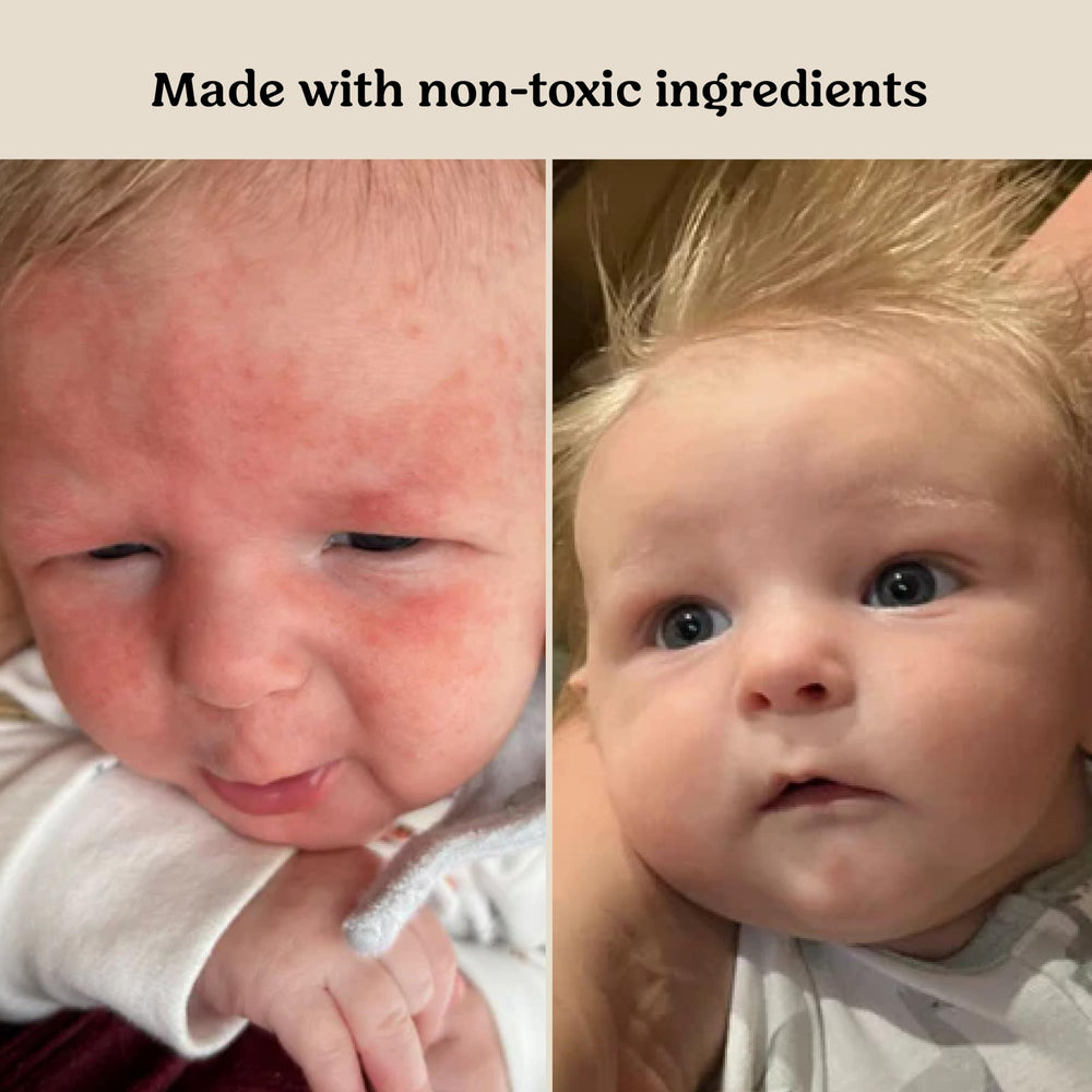 Roe Wellness baby cream lotion ointment antioxidants closeup emphasizes protection and soothing care
