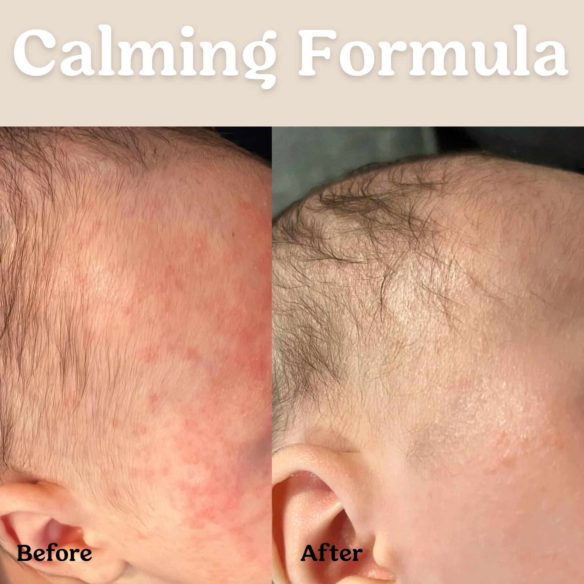 Roe Wellness 24-hour hydration on baby cheeks and limbs