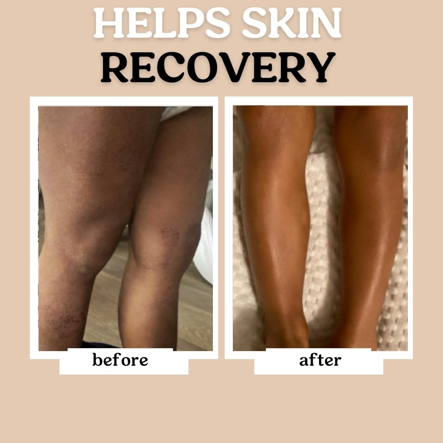 Roe Wellness body application demonstrates quick absorption with no greasy residue