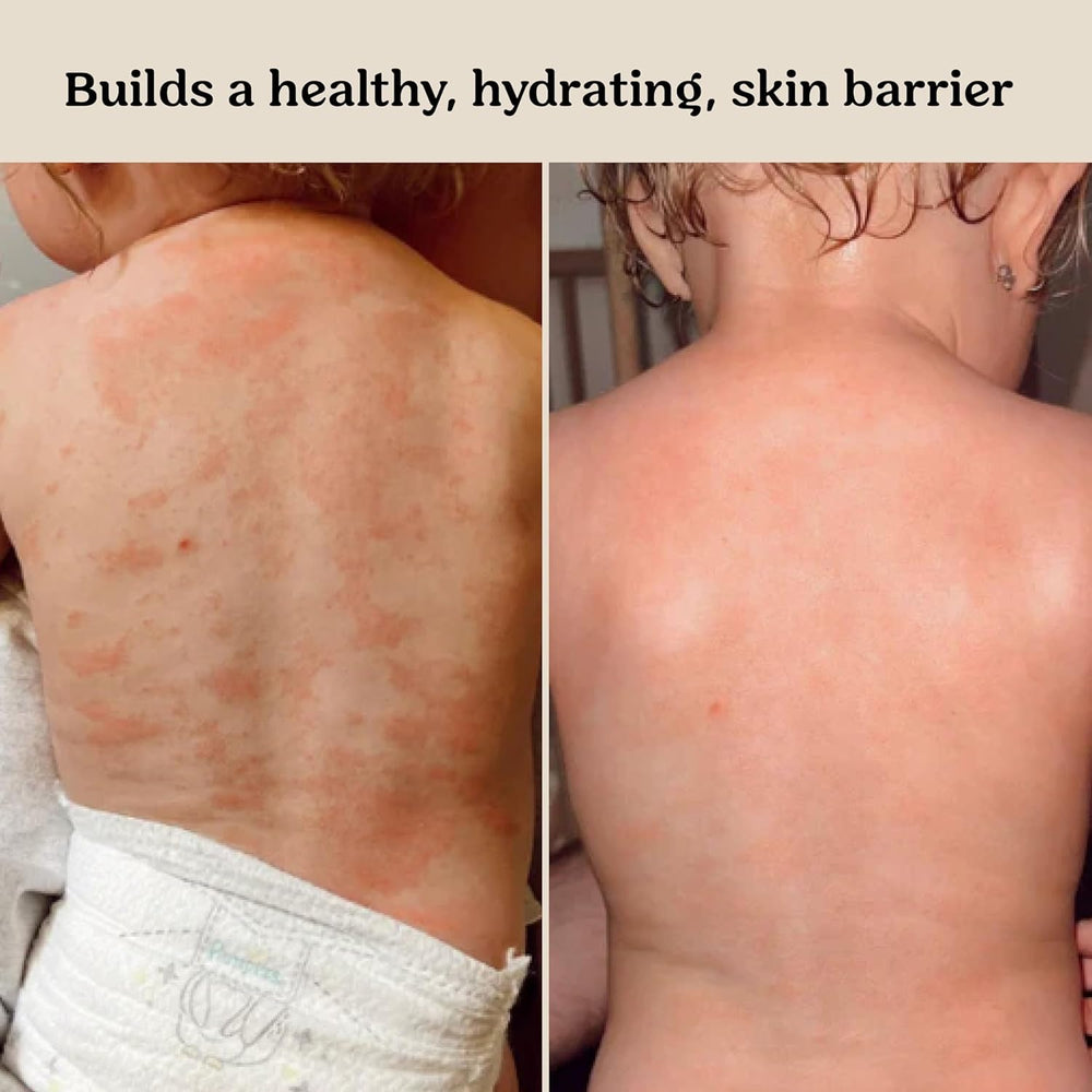 Roe Wellness fragrance-free lotion ideal for sensitive skin and gentle care.