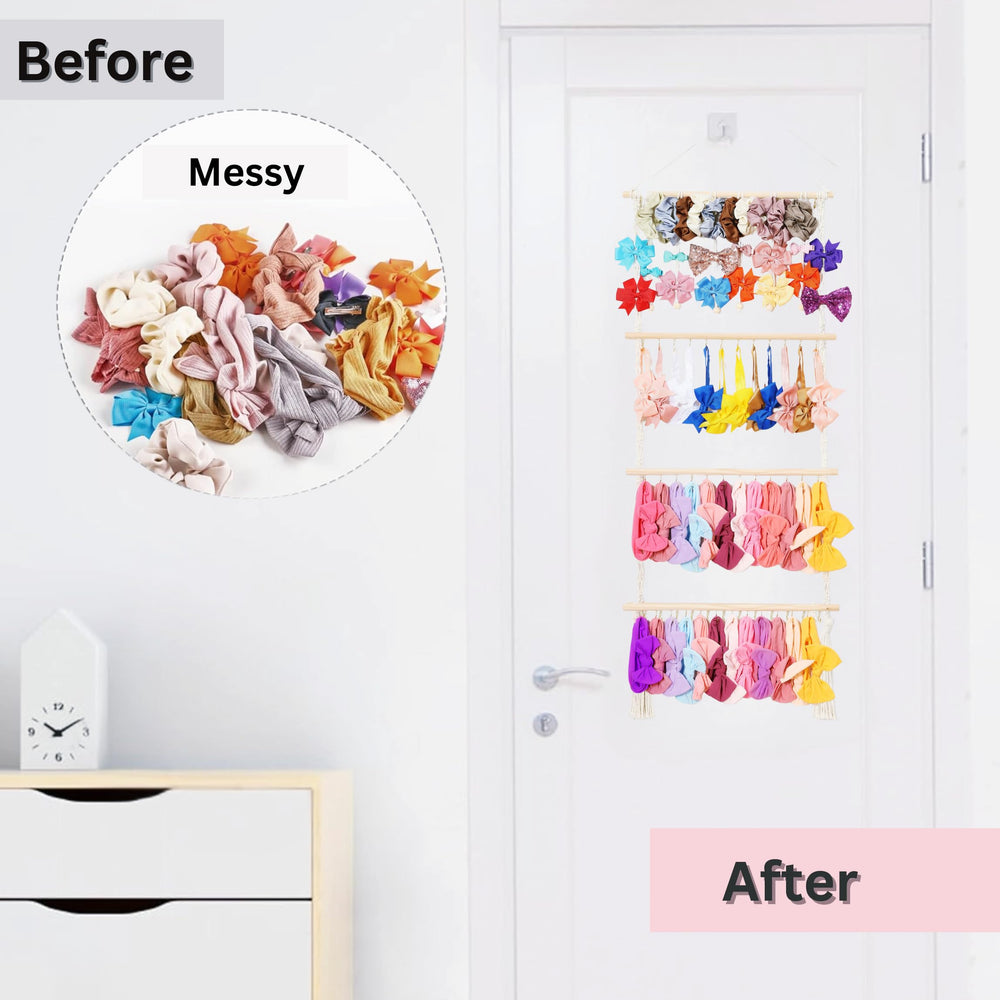 Shineloha all-in-one storage for bows clips ties and pins