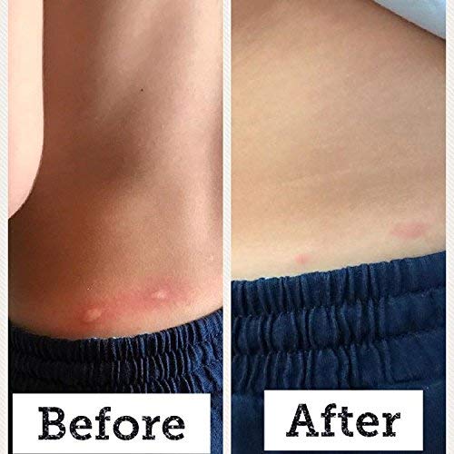 SIANI BabyBiotics skin irritations close-up showing soothing formula