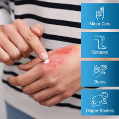 TenderGentle baby skin care ointment used on delicate skin areas.