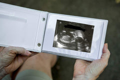 The Grandparent Gift Co. ultrasound organizer shows ultrasound images; ideal for unifying baby moment memories.