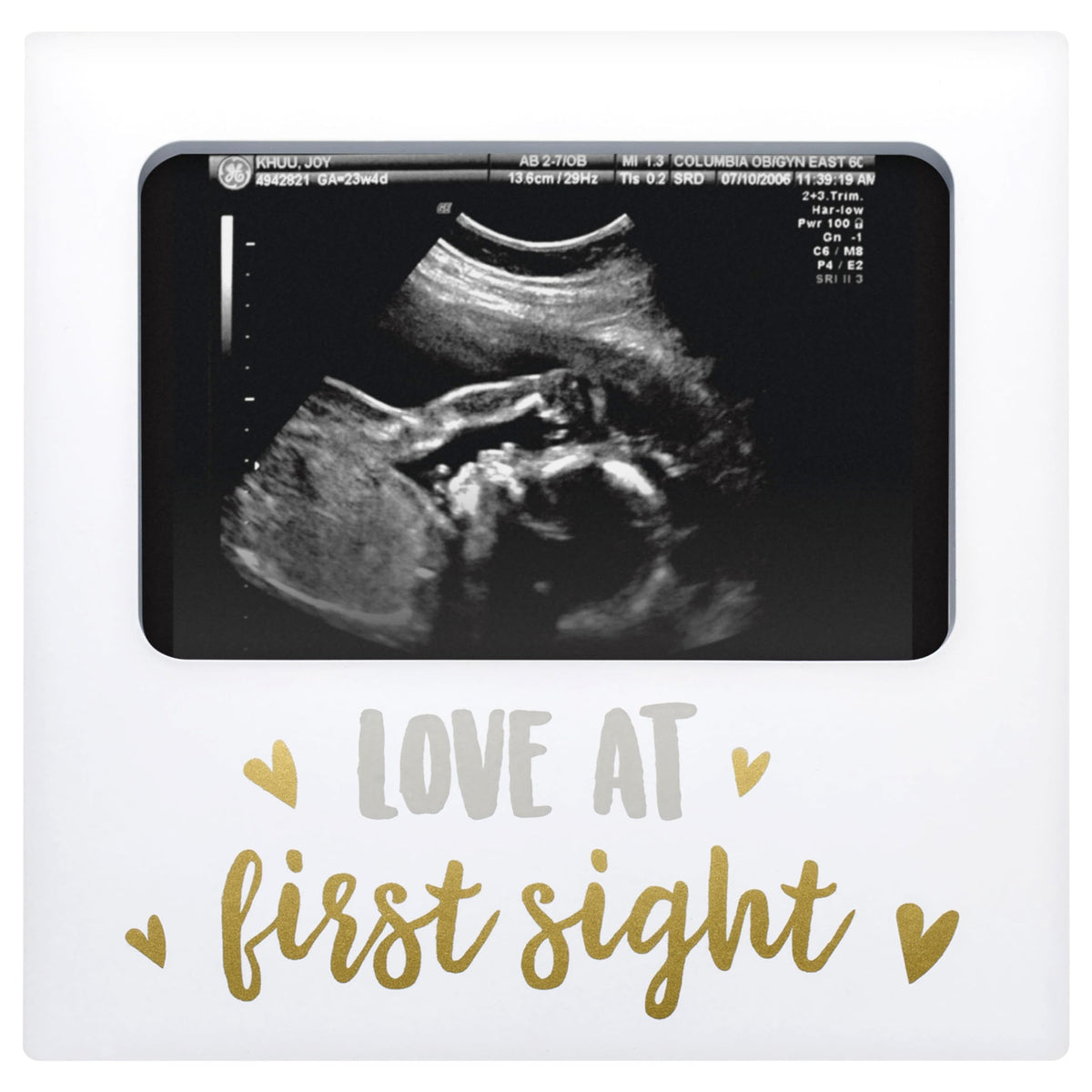 Tiny Ideas Love at First Sight wall display showcases your baby's first ultrasound memory.