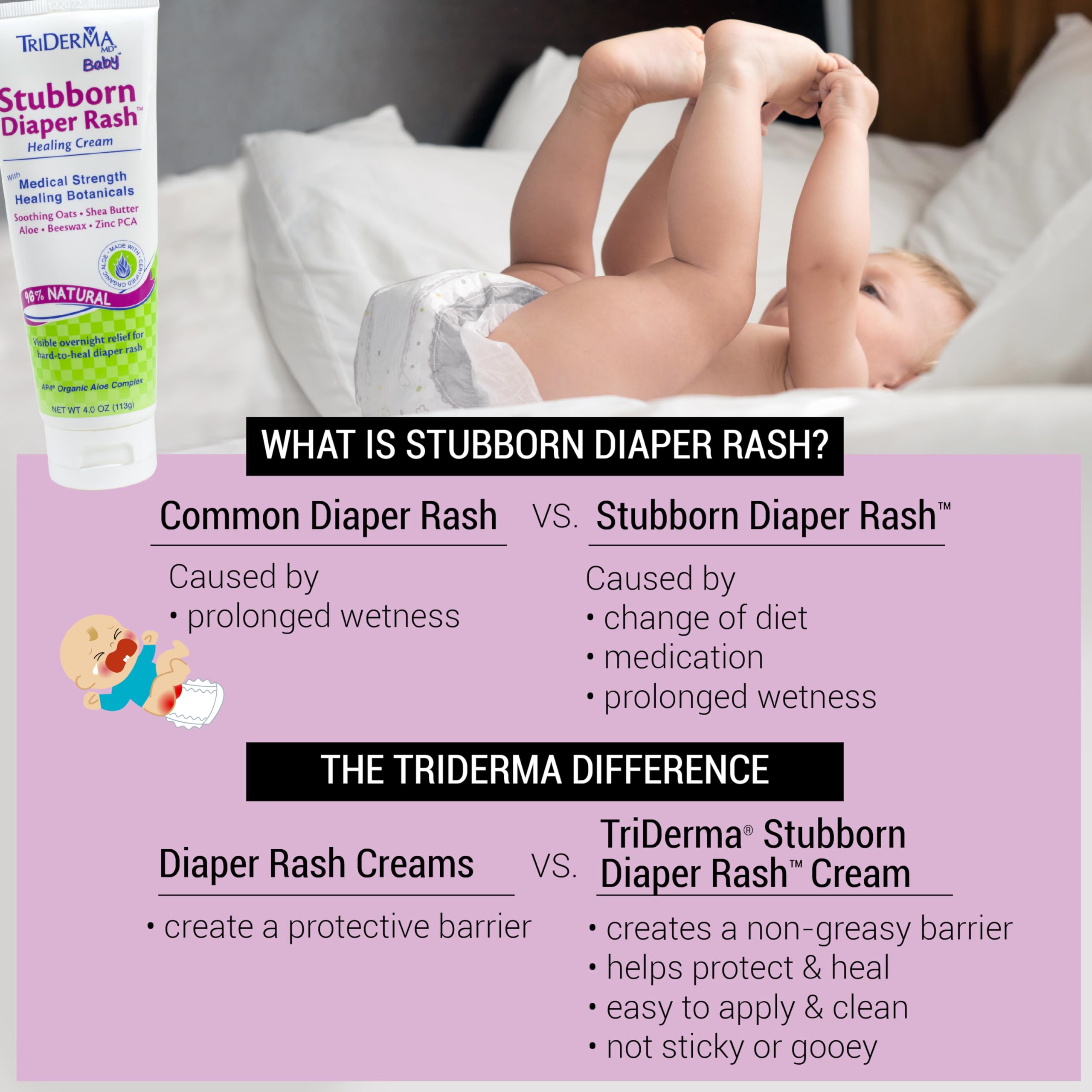TriDerma MD Baby application demonstrates quick, non-greasy barrier protection.
