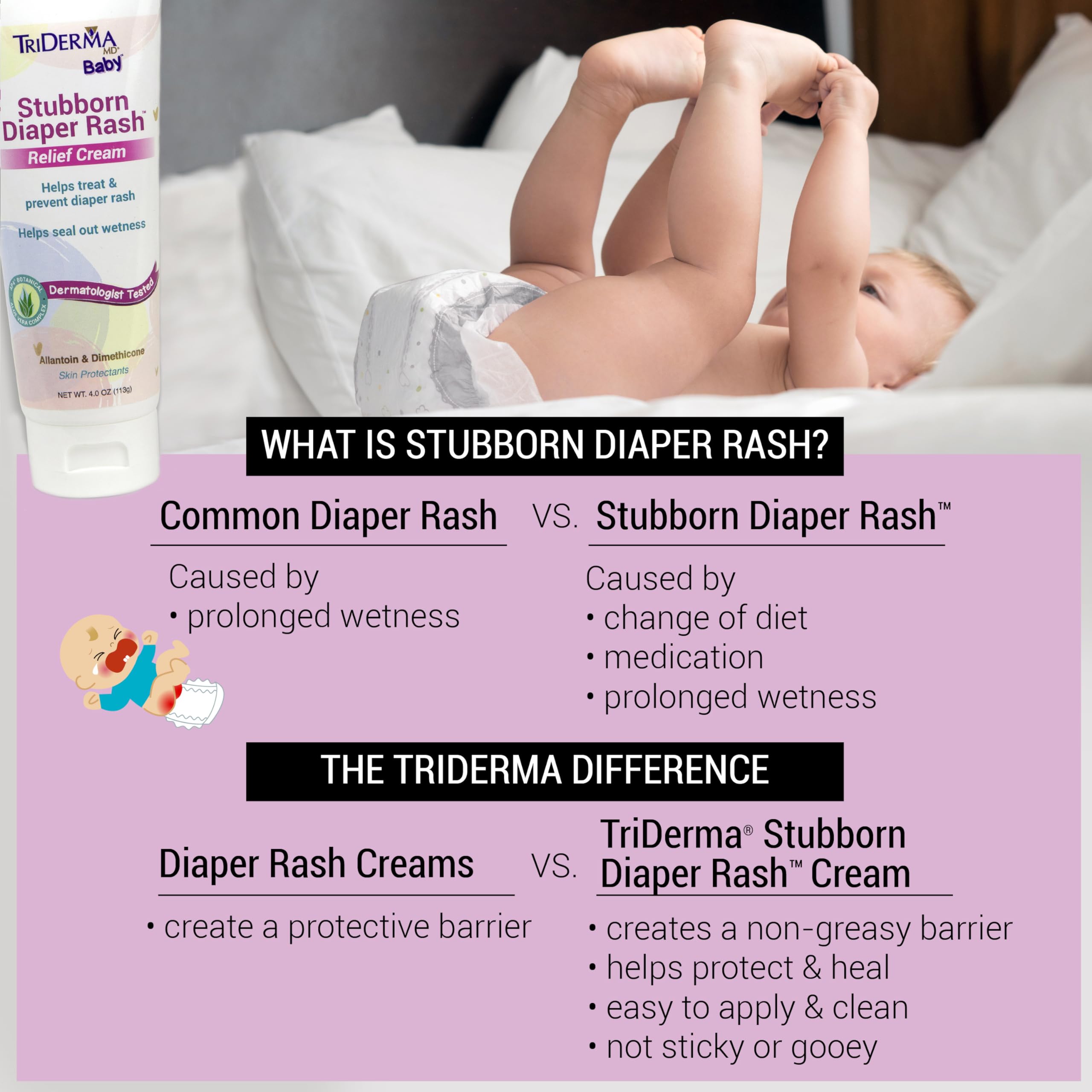 TriDerma Stubborn Diaper Rash Cream tube back with product details and usage guidance.