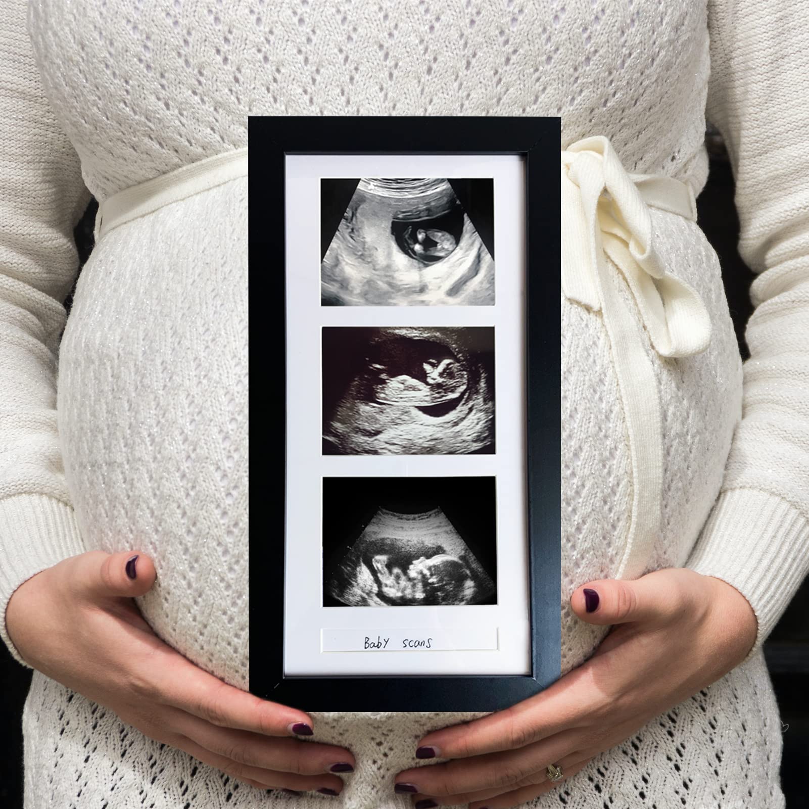 trlry triple ultrasound frame shows 3 photos for pregnancy memories
