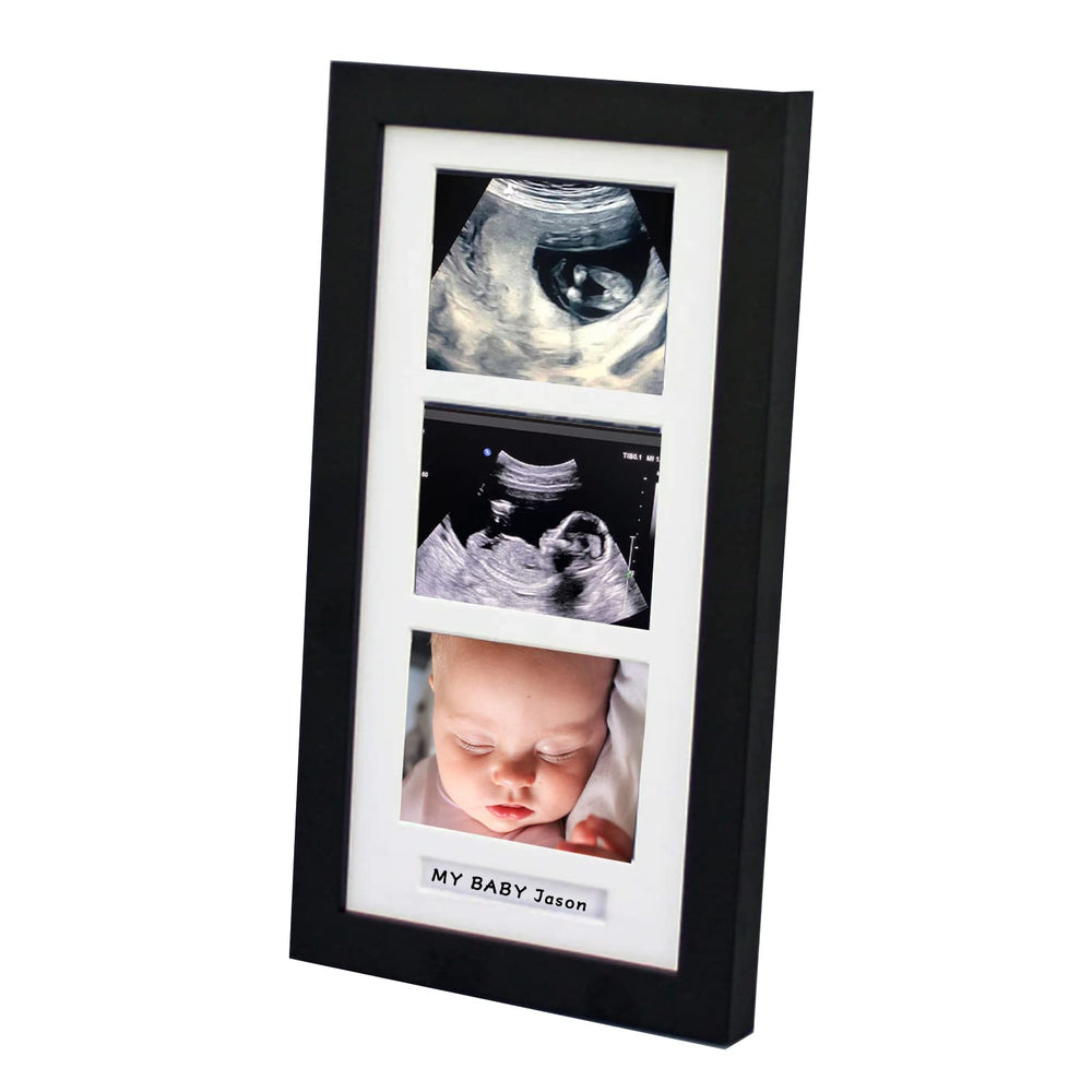 trlry triple ultrasound frame front view with three photo slots for memories