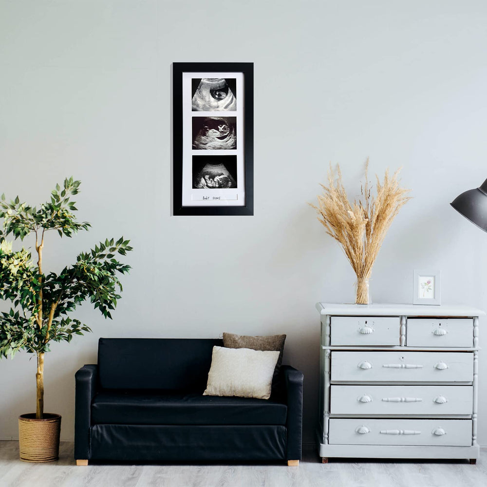 trlry triple ultrasound frame wall hanging ready for quick display
