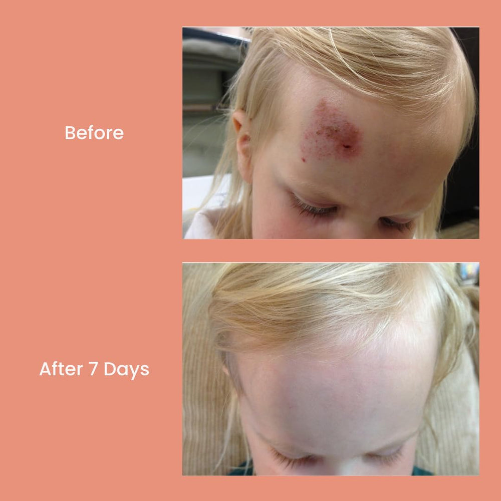 TrueLipids Boo-Boo & Bum Balm safe for babies with fragrance-free and hypoallergenic formula