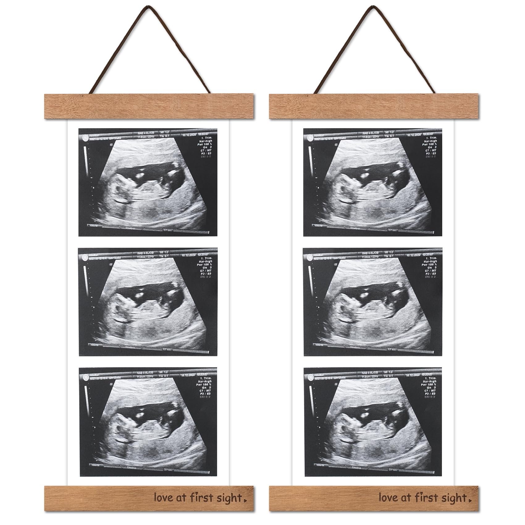 Zyeco sonogram frame on fridge displays ultrasound photos for cherished memories