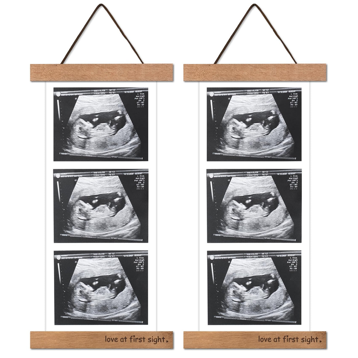 Zyeco sonogram frame on fridge displays ultrasound photos for cherished memories